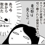 ホクロを取った話 その3